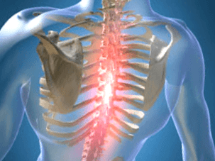 Wiederkehrende oder anhaltende schmerzende Schmerzen bei thorakaler Osteochondrose